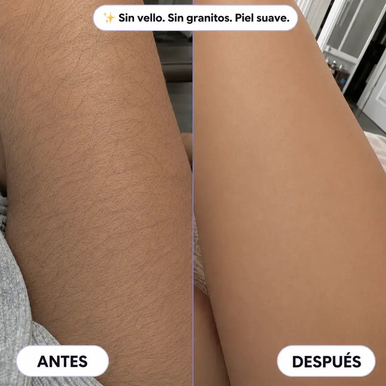 NudeSkin™ Piel de Seda
